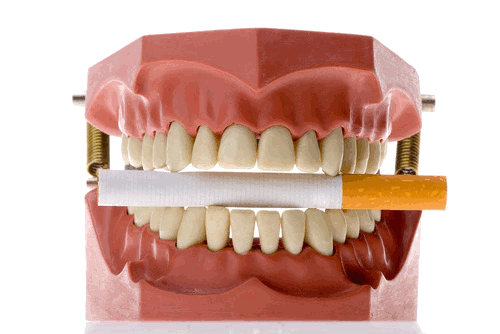 dentalhealth-tobacco